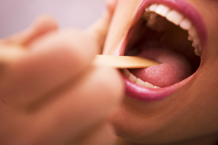 Viêm vòm họng có thể gây ung thư vòm họng