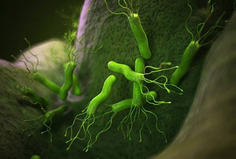 Xét nghiệm vi khuẩn Hp giúp hạn chế nguy cơ biến chứng, tránh lây lan bệnh