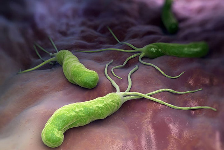 Vi khuẩn HP kí sinh ở đâu - Dạ dày là môi trường sinh sống của loại khuẩn này